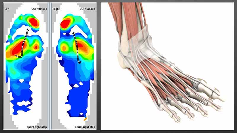 Foot Pressure Mapping