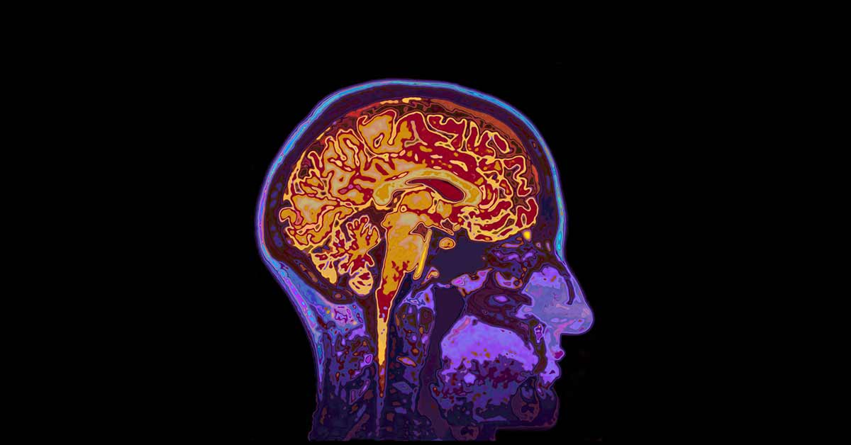 Concussion Brain Mapping