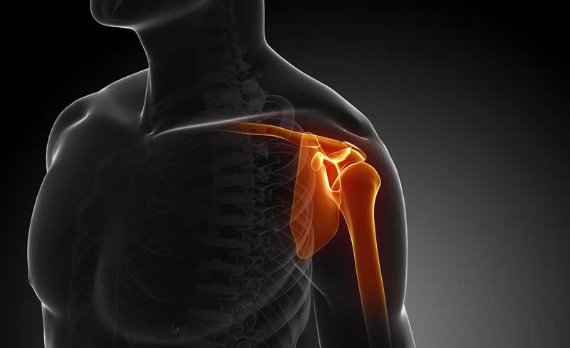 Shoulder Joint Risk