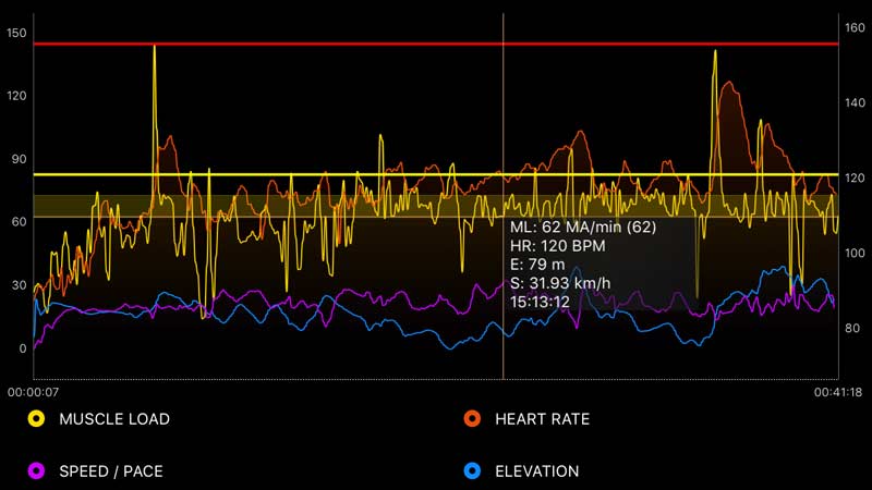 Myontec EMG