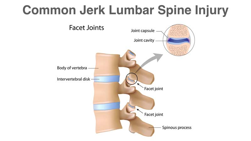 Lumbar Jerk Spine