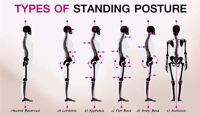 Static Posture