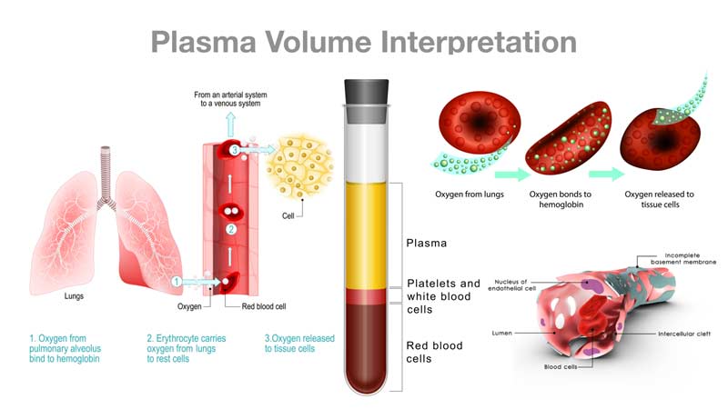 Plasma Volume