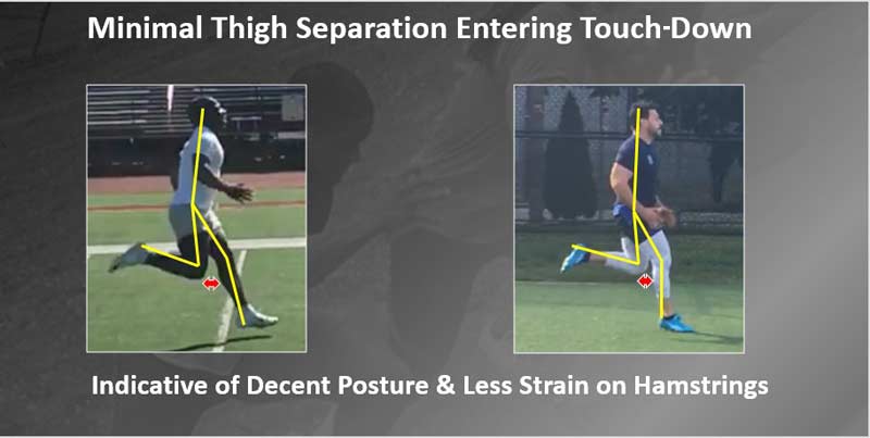 Minimal Thigh Separation