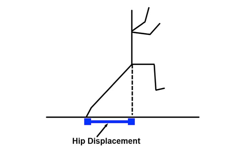 Hip Displacement