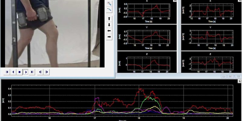 Unilateral Bilateral EMG