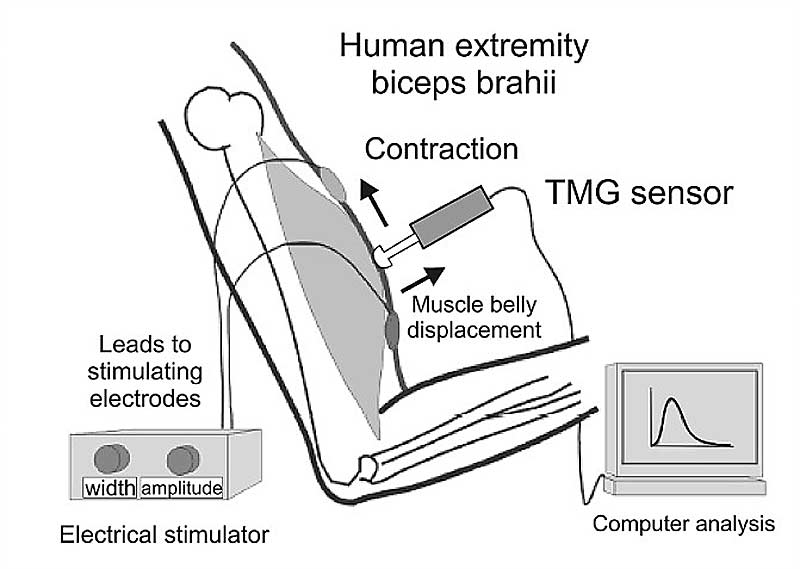 TMG Sensor