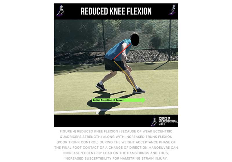 Reduced Knee Flexion