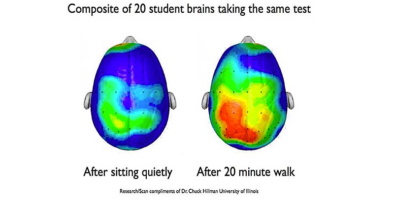 Brain Scans