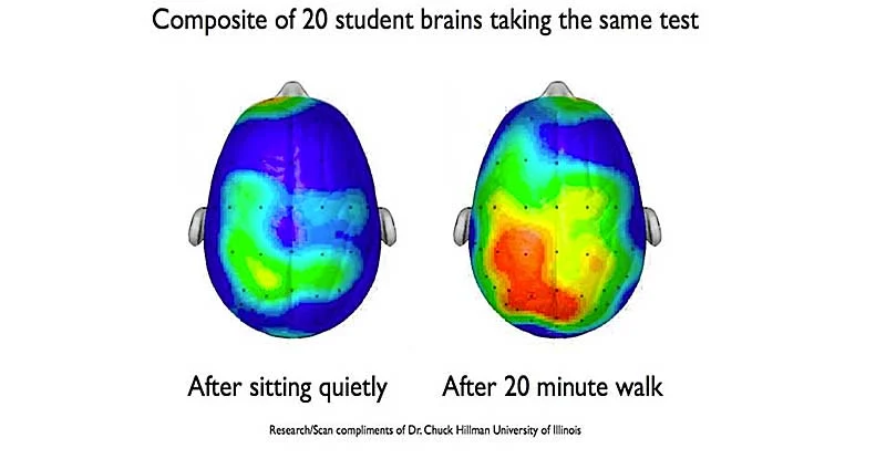 Brain Scans