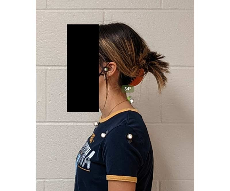 Posture