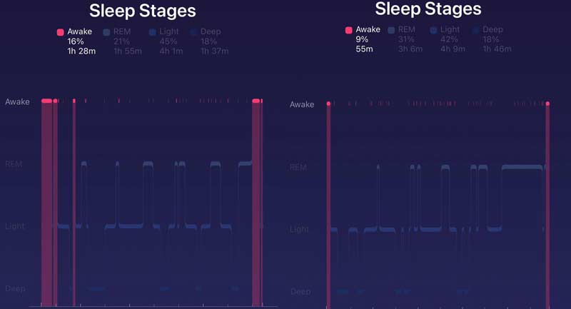 Sleep Stages