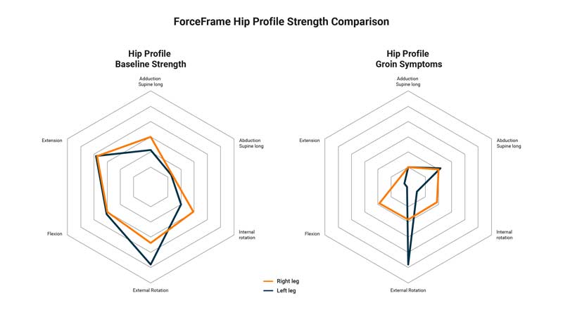 Hip Profiles