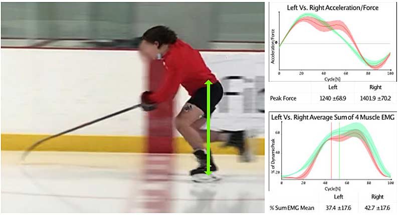 Hockey Acceleration