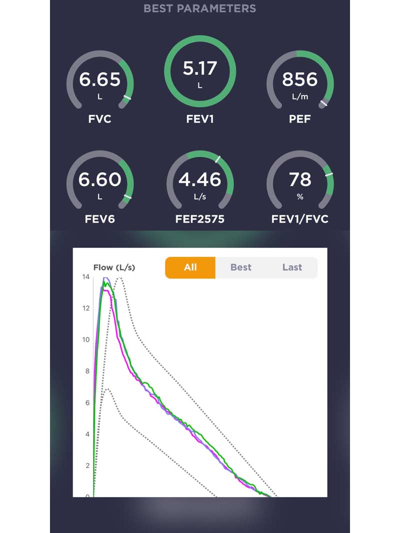 Spirometry Results