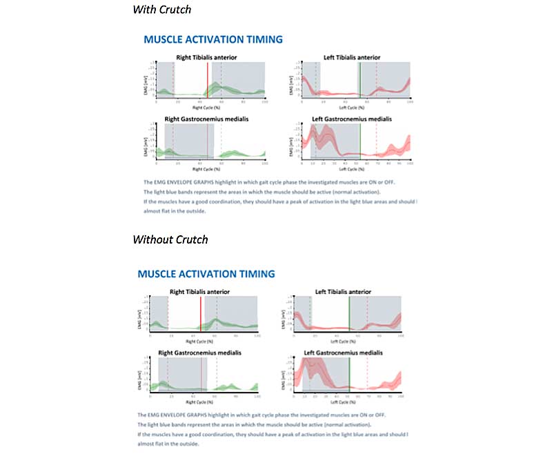 Muscle Activation