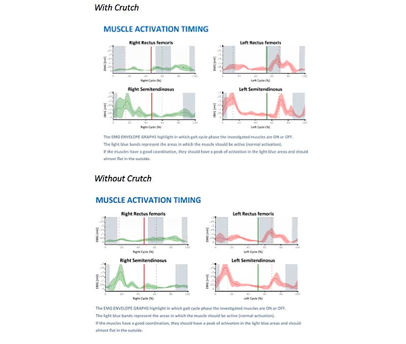 Activation Timing