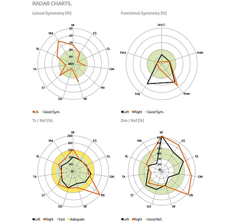 Radar Chart