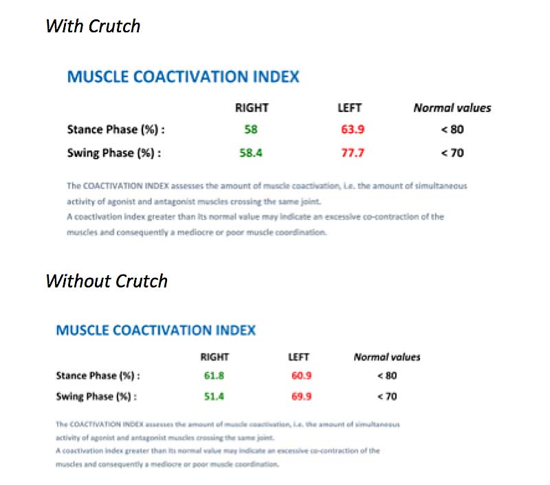 Upper Leg Coactivation