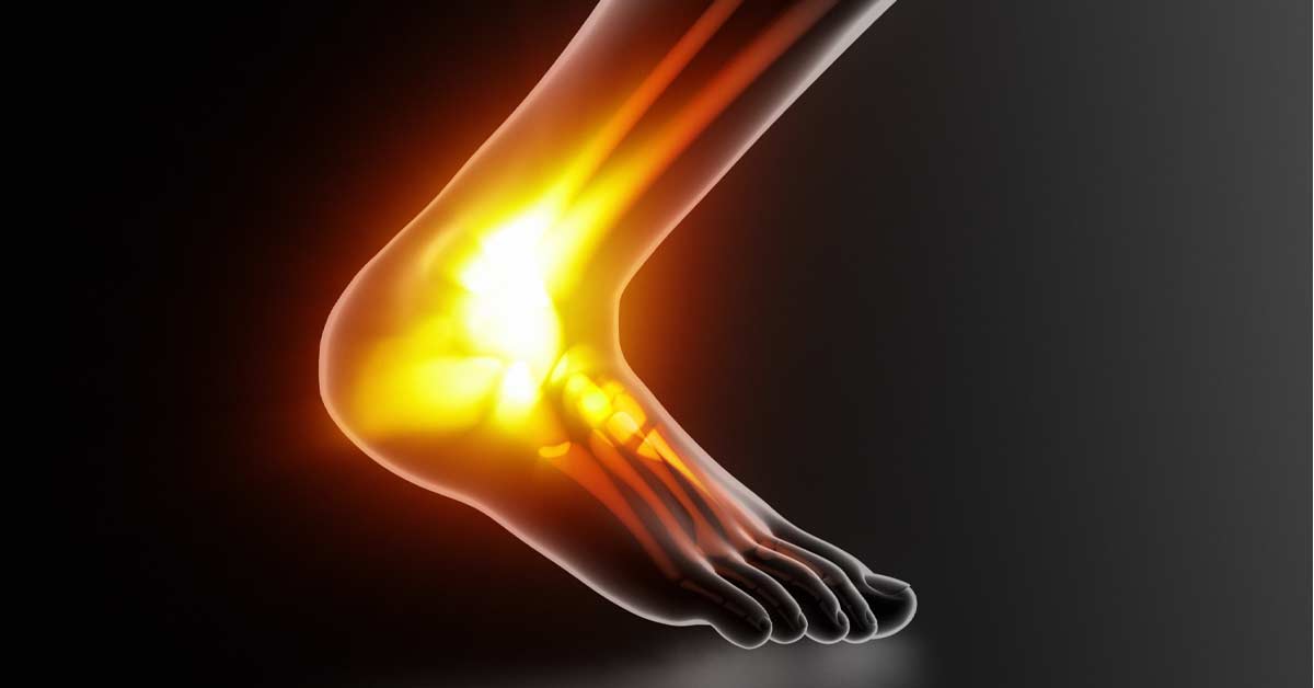 Achilles Thermo|Thermohuman Achilles Tendon|Eccentric Calf Raises|Surface Trail Running