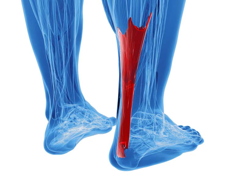 Achilles Tendon