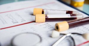Blood Sample