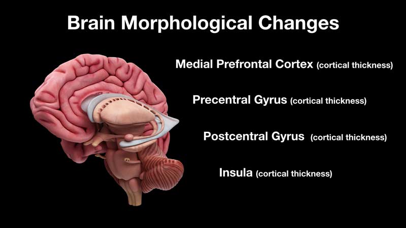 Brain Building VM Pro