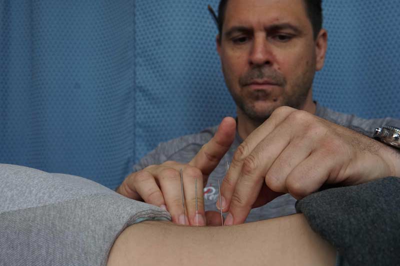 Complementary Therapies