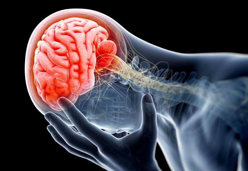 Concussion