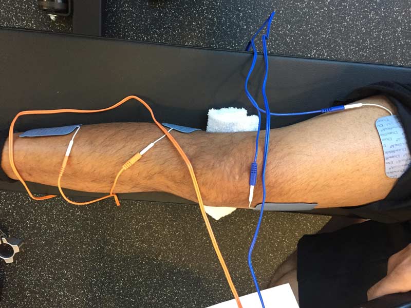 DH EMS ACL