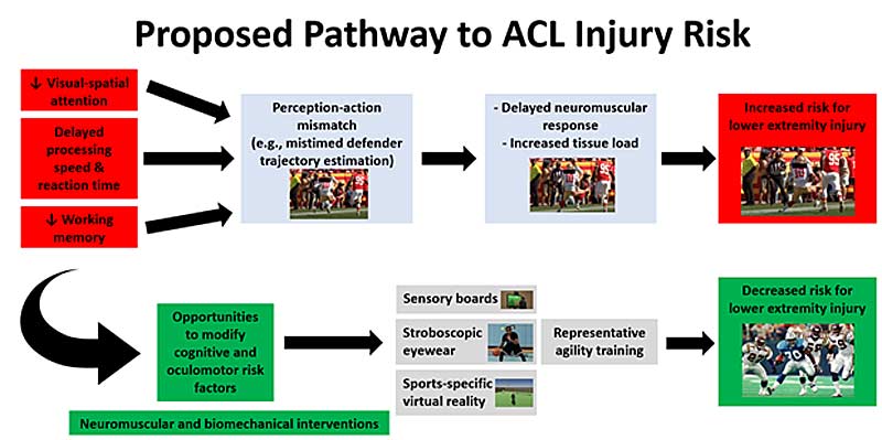 ACL Risk Pathway