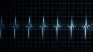 Heart Rate Variability Chart|HRV Data Set|Progressive HRV Trend|HRV Swim Data Set|Collegiate Runner HRV Data|HRV Fluctuations
