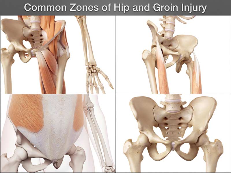 Hip and Groin