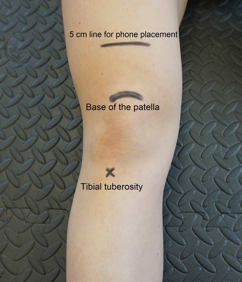 Assessment-Figure