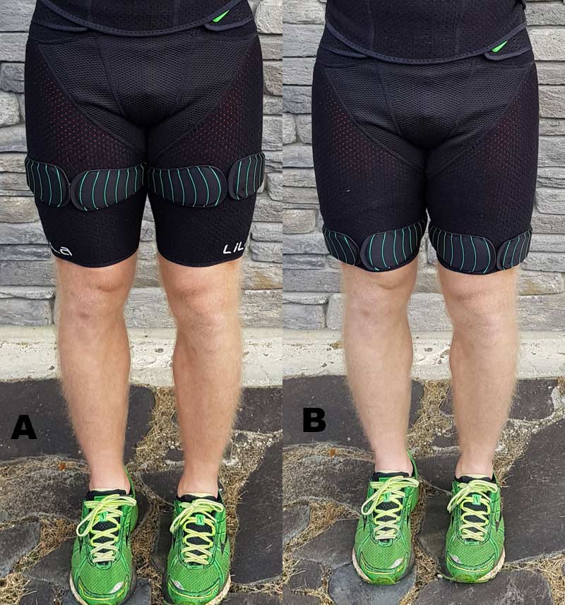 Mid Thigh Distal Thigh