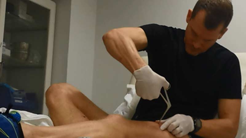 Muscle Biopsy