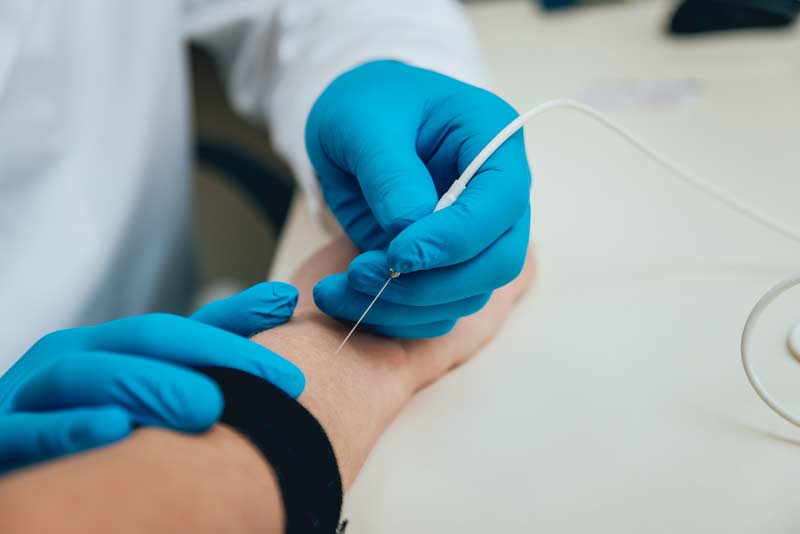Nerve Testing
