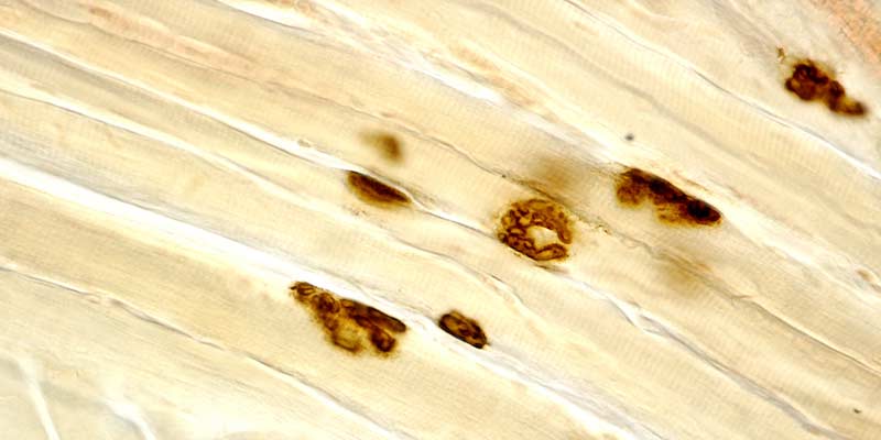 Neuromuscular Adaptation