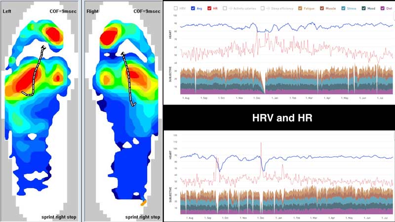 Pressure Mapping Foot Function
