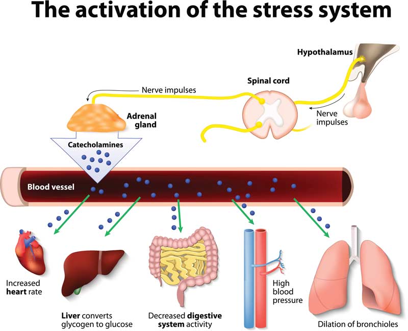 Stress