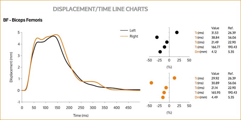 TMG Muscle Displacement