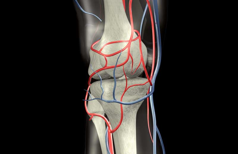Vascular Leg