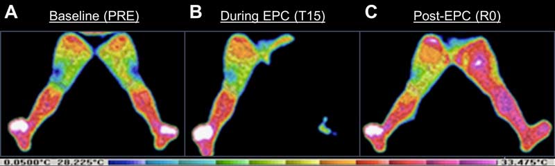 Thermographic Image